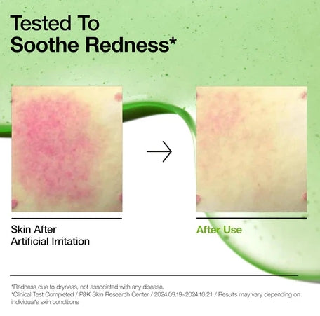 Anua Azelaic Acid 10% Hyaluron Serum - Redness Relief & Soothing - 30ml