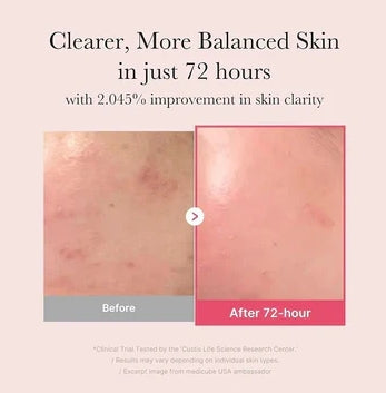 Medicube TXA Niacinamide 15 Serum – Brightening & Glow