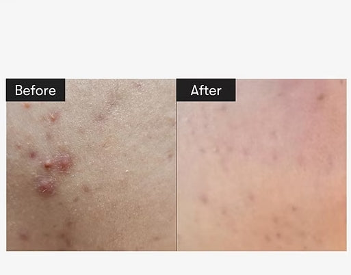 VT Reedle Shot 100 50ml – Skin Renewal & Brightening Serum