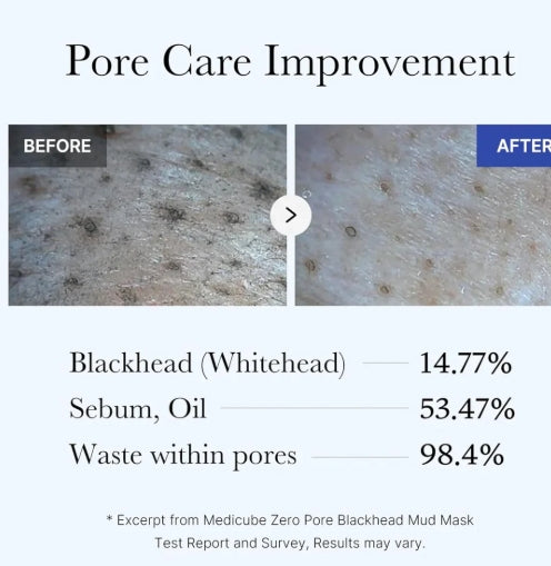 Medicube Zero Pore Blackhead Mud Mask 100g – Deep Clean & Pore Care