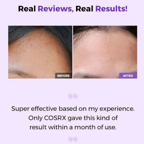 COSRX AHA BHA Clarifying Treatment Toner 200ml – Exfoliating & Hydrating Toner for Smooth, Clear Skin