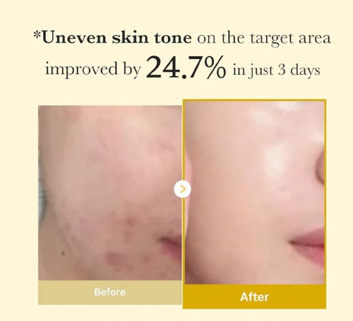 Medicube Kojic Acid Turmeric Night Wrapping Mask – 75ml | Brightening & Hydrating Overnight Treatment