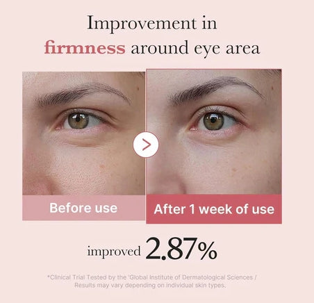 Medicube PDRN Peptide Eye Cream 30ml – Anti-Aging, Wrinkle Care & Brightening Eye Treatment